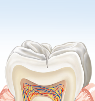 Как се образува зъбният кариес?